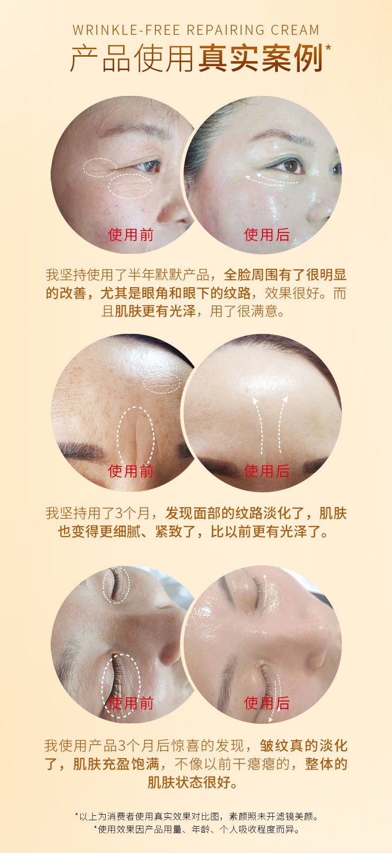 默默淡纹修护霜（默肤因） - 图2